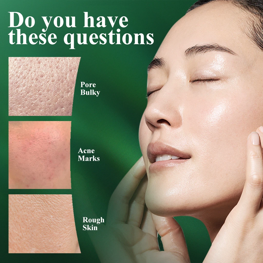 MABREM Pore Shrinking Serum Essence Pores Treatment Moisturizing Relieve Dryness Oil-Control Firming Repairing Smooth Skin Care 3