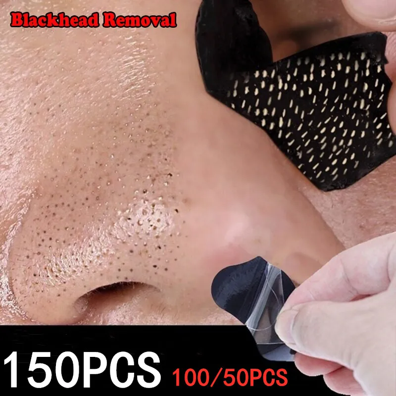 Severe Blackheads On Nose