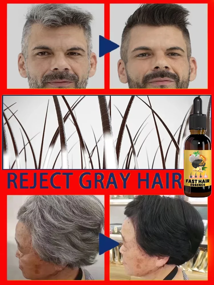 Tueur de cheveux blancs, &eacute;limine les cheveux blancs en 7 jours et restaure la couleur naturelle des