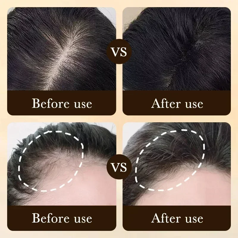 Natural Hair Growth Oil Efficient Anti Hair Loss Nourishing Essential Oil For Dense Repair Damaged Moisturizing Smooth