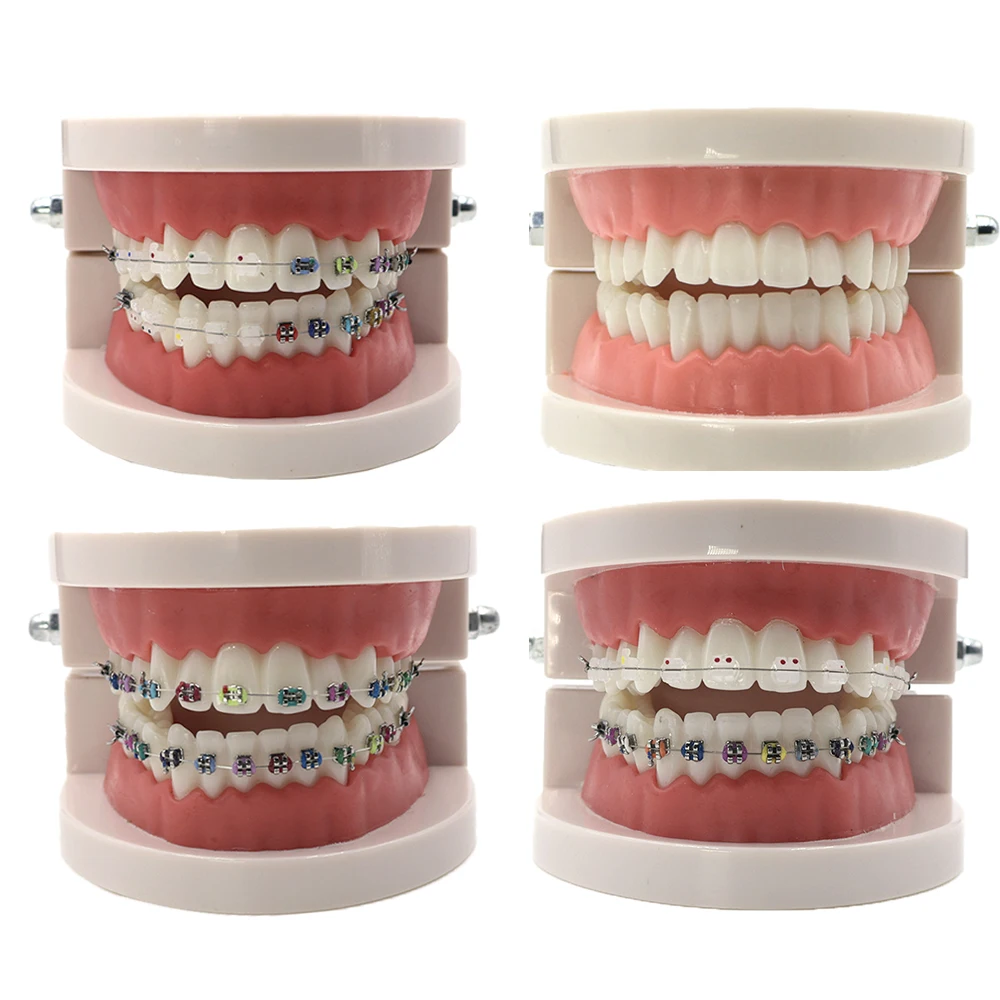 

Dental Standard Teeth Model Typodont Metal / Ceramic Brackets For Demonstration