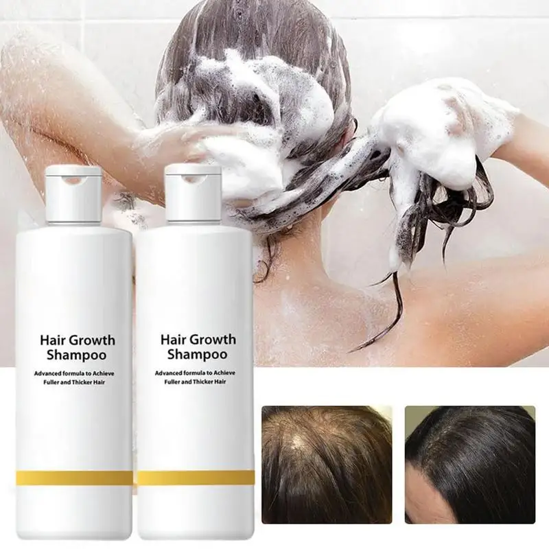 

80z/ 120z Shampoo For Hair Loss Cleansing Shampoo Anti Thinning Shampoo Hair Thickening Shampoo For Women & Men Natural Shampoo
