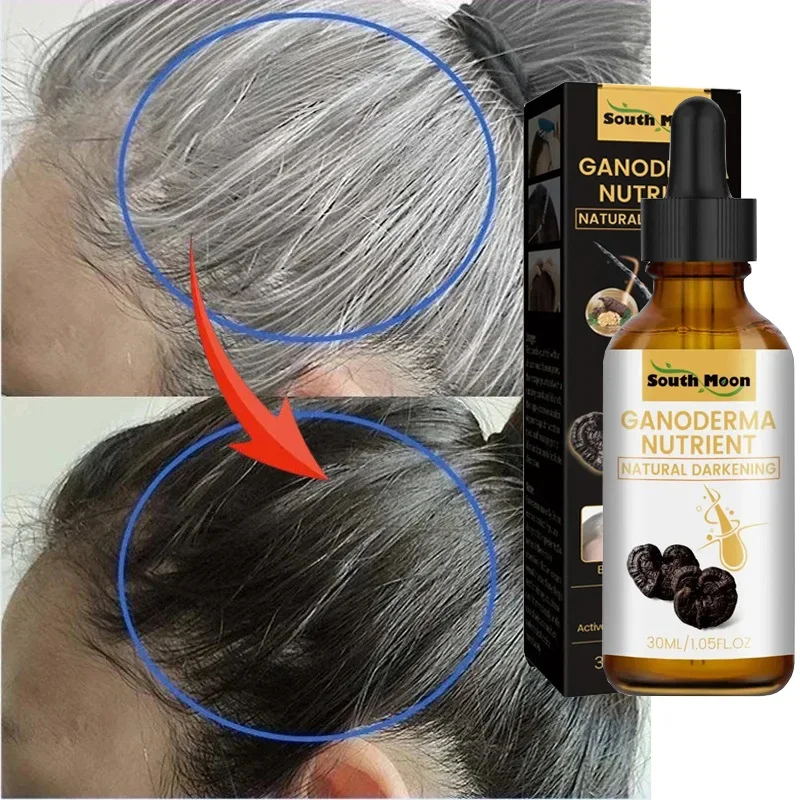 

Gray White Hair Treatment Serum Liquid White To Black Natural Color Repair Nourish Scalp Anti Loss Hair Care Products Men Women