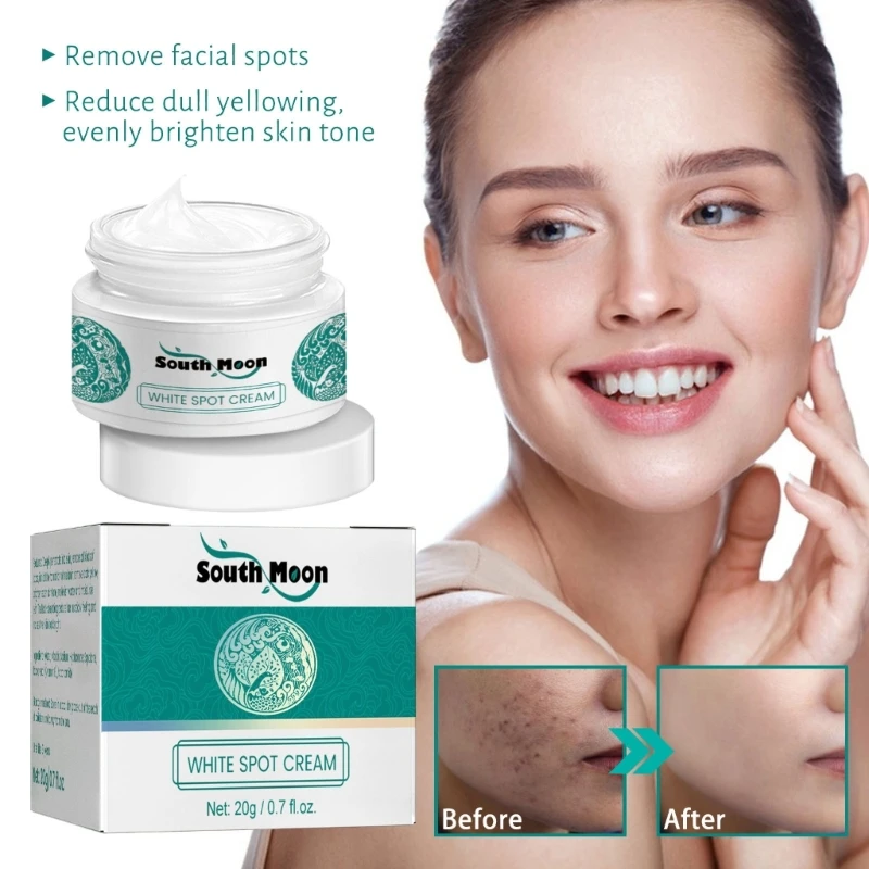 

Dark Spot Corrector Cream Moisturizing Remove Spots Sunburn Dark Spot Corrector Freckles Age Skin Care Face Cream