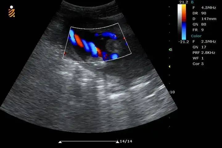 Рисунок 6 - 2022 горячая Распродажа BPU90