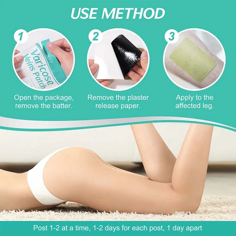 Z20 10PCS Varicose Veins Patch Treatment For Varicose Veins Vasculitis Phlebitis Spider Leg Medical Patch Angiitis Removal