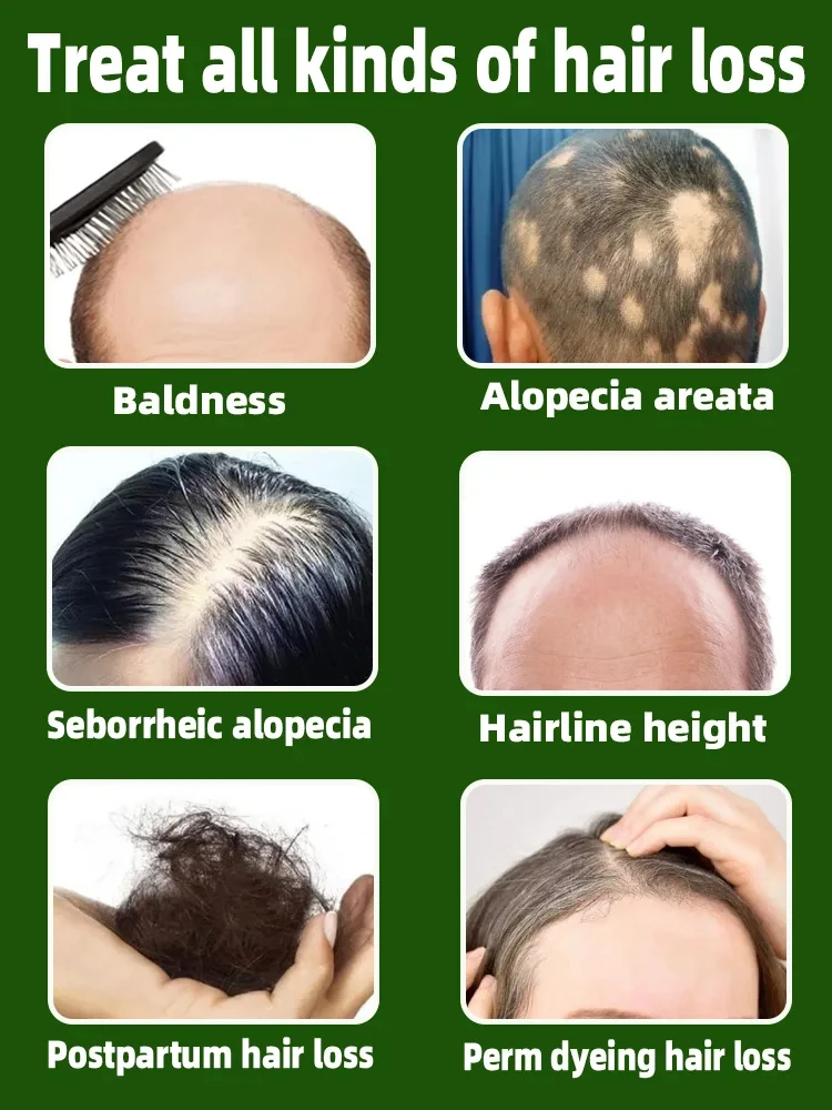 Hair Growth Products Hair Growth Products 2024 Repair Baldness Hair Loss