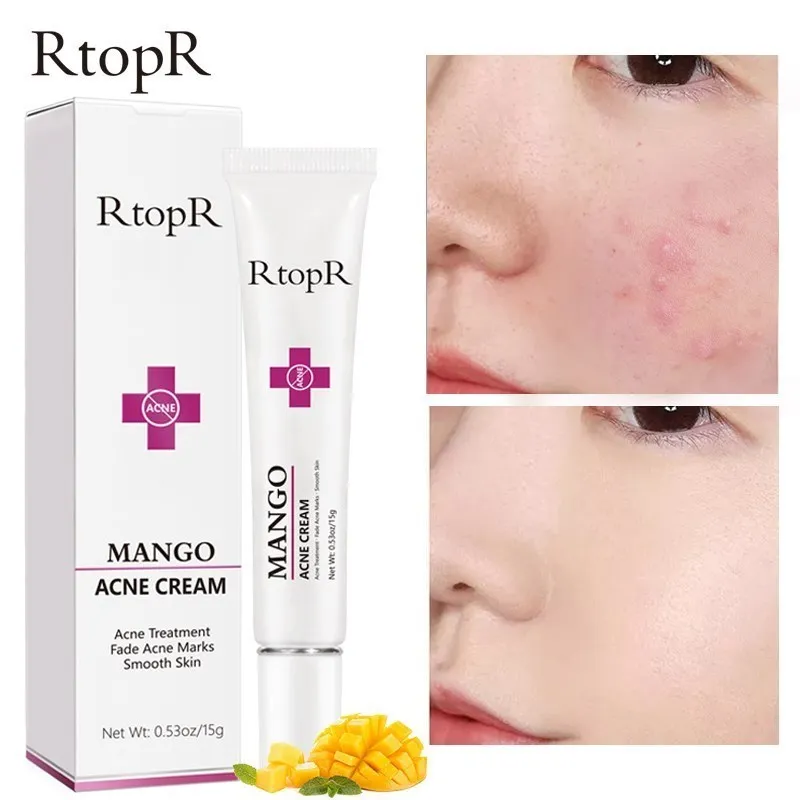 Acne Treatment Face Cream Blackhead Repair Oil Control Shrink Pores