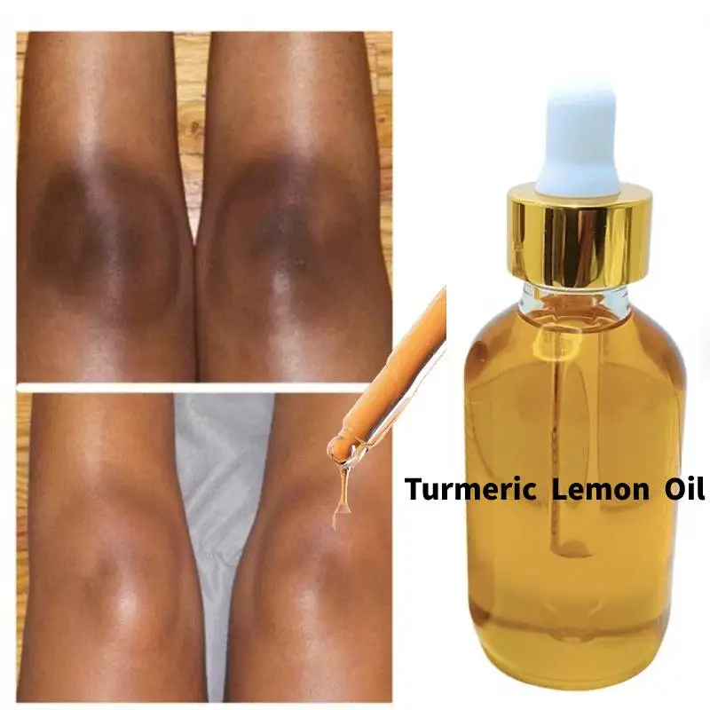 

Turmeric Lemon Oil Skin Glow To Lightening Acne Dark Patches Acne Bright Skin Dark Spot Corrector Face Whitening Serum Skin Care