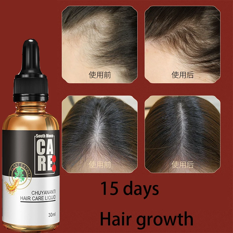 

Anti hair loss liquid hair growth agent for dense hair growth, hairline growth liquid for hair enhancement