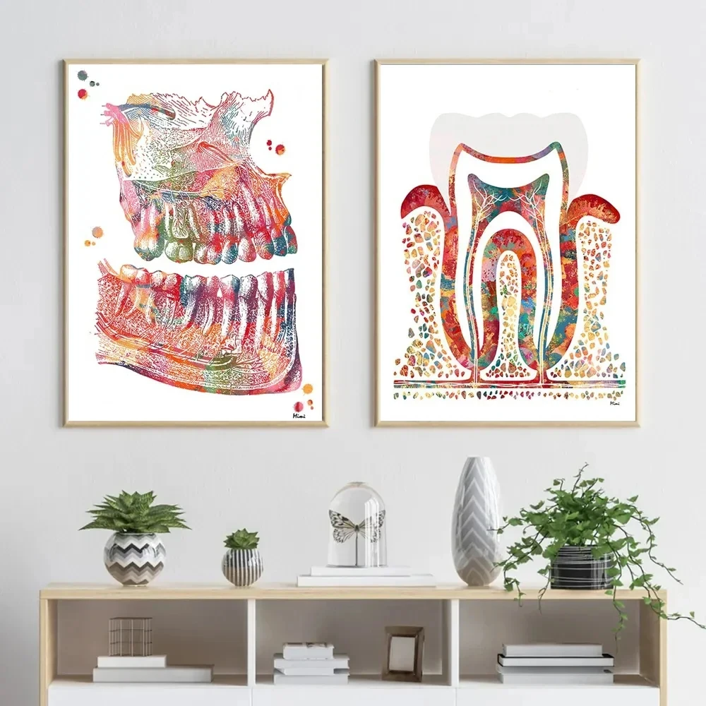 Modern Dental Art - Tooth Implant Anatomy Canvas Poster
