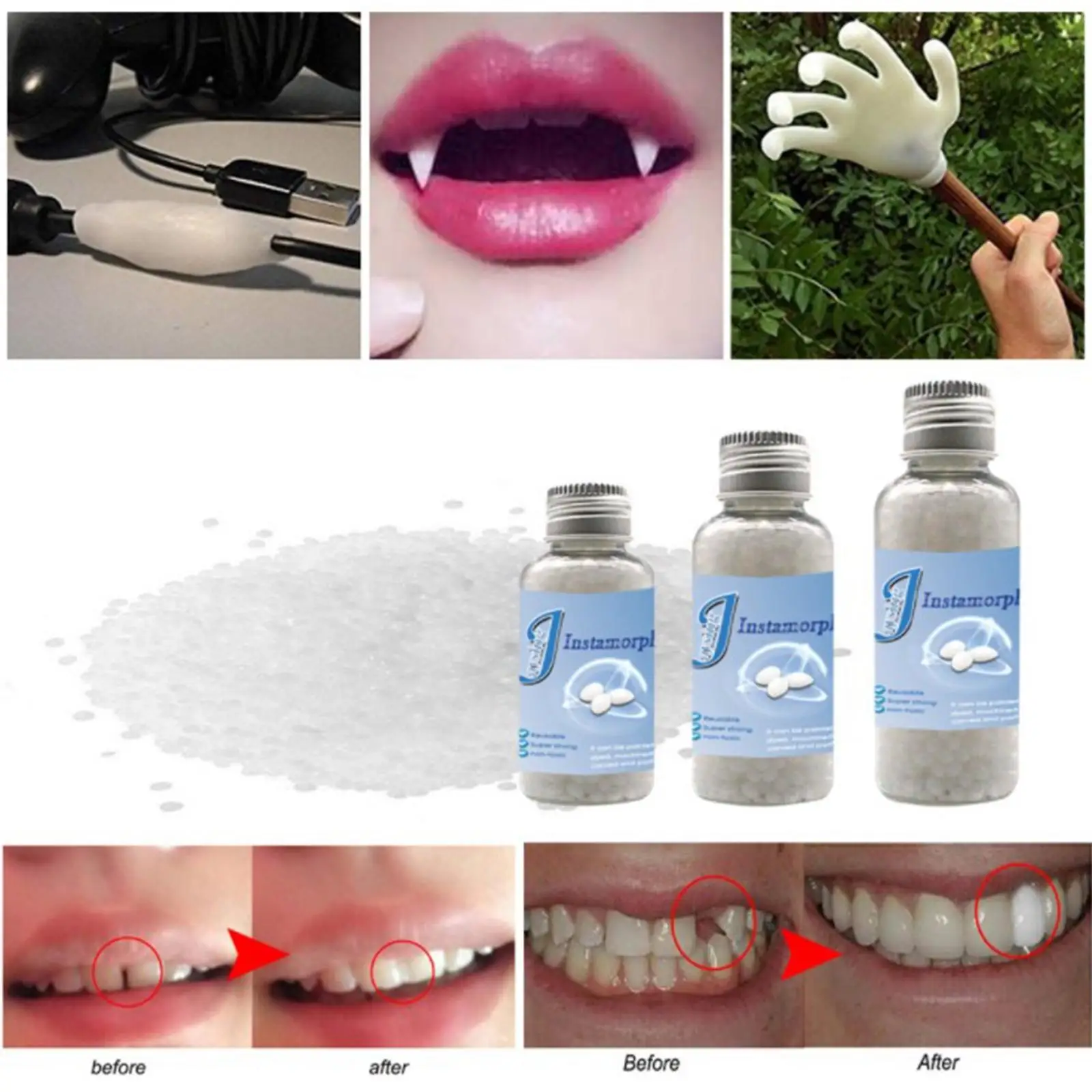 thermal fitting beads teeth veneers moldable