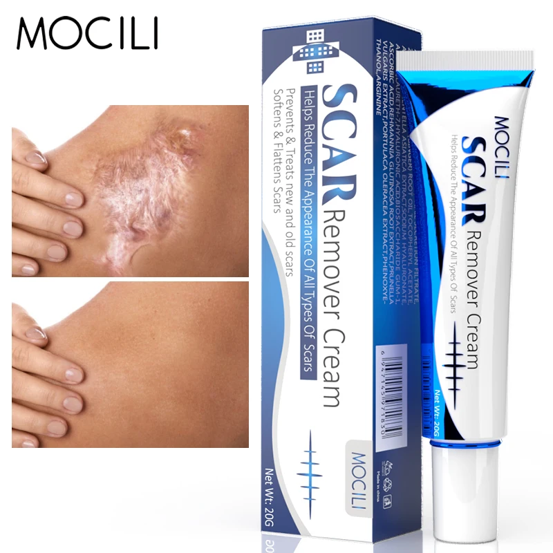 Scar Remover Cream Whitening Moisturizing Fade Scars Repairing Pock