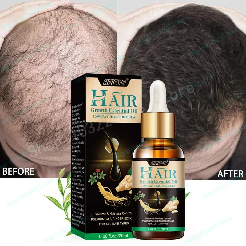 

Natural Ginger Hair Growth Spray Hair Roots Fast Grow Anti Hair Loss Serum Liquid Scalp Damaged Treatment Repair Beauty Health