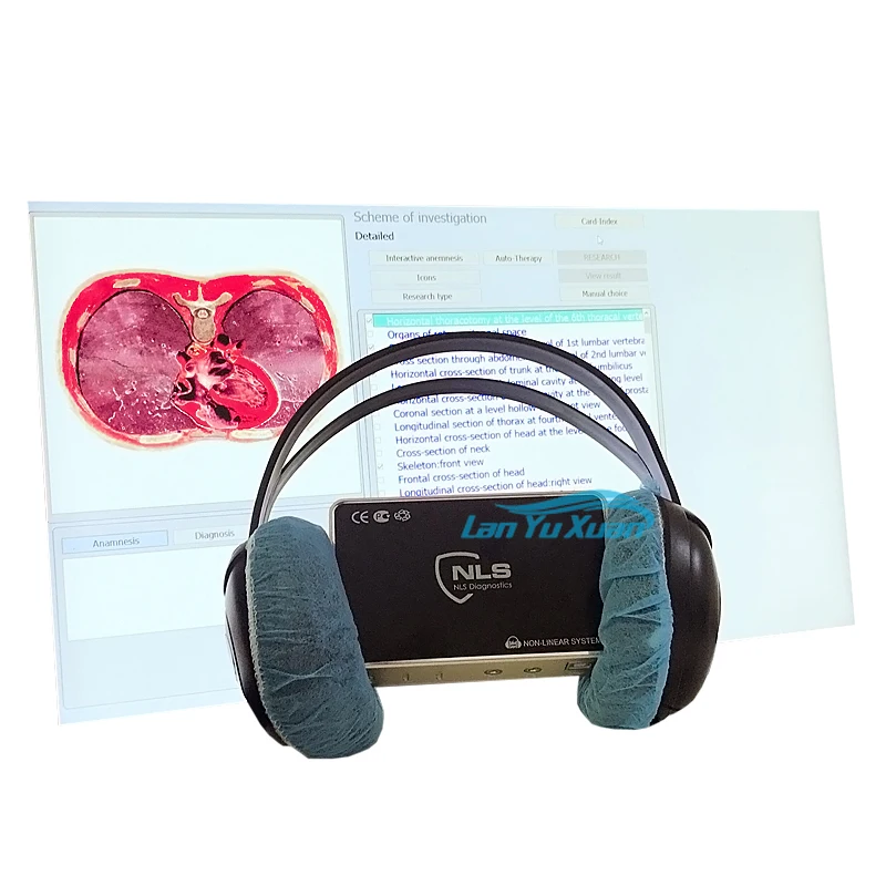 

Factory price 9d nls health auto blood chemistry analyzer