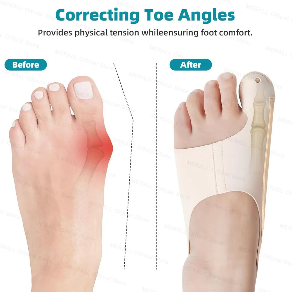 Toe Separators Toe Corrector Toe Protector Big Toe Bunion Corrector Adjustable Orthopedic Socks Hallux Valgus Feet Protector Foot Care Tools
