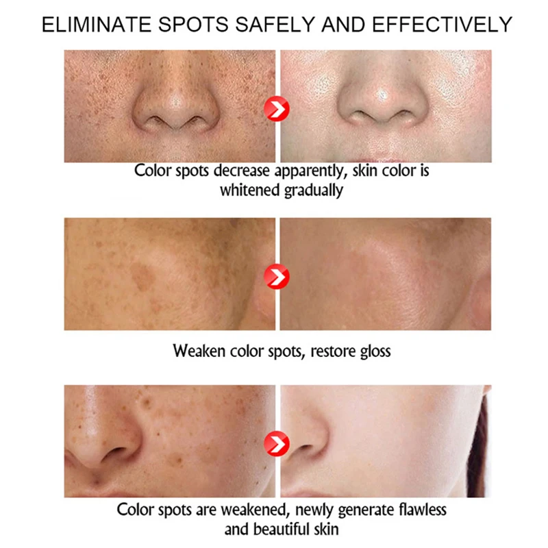 Kojic Acid Face Whitening Serum Glutathion Remove Blemish Dark Spot Correcting Glow Serum Face Skin Care Moisturizer Cosmetics 2