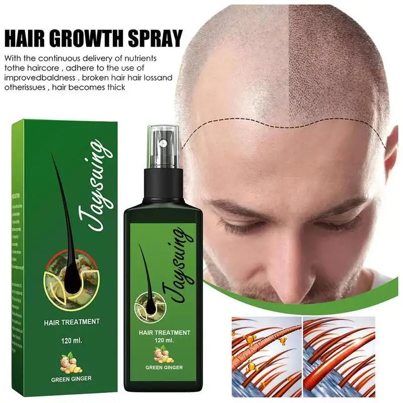 Hair Growth Spray Fast Ginger Roots Grow Anti Hair Loss Serum Liquid Scalp Damaged Treatment Repair Care Products Beauty Health