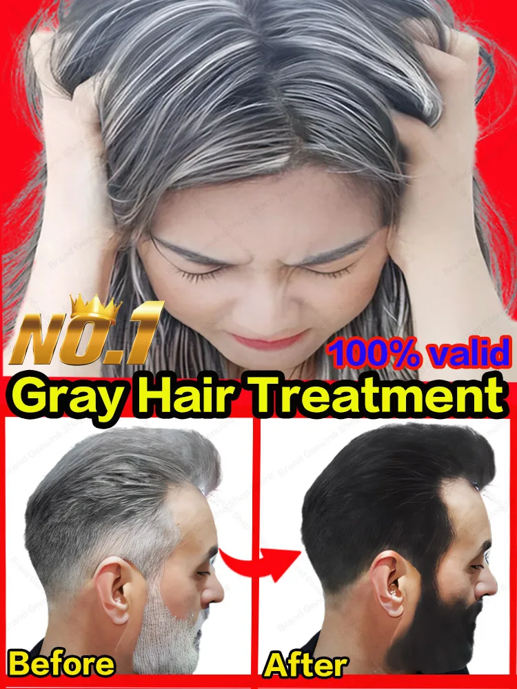 

Anti Gray Hair Serum Remedy White Darkening