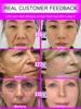 20 years younger，Wrinkles disappear 2