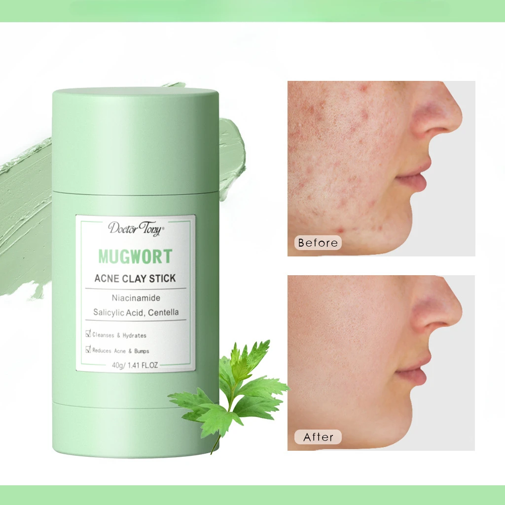 Mugwort Mud Mask Stick cleanses and improves acne skin Deep cleaning Hydrate and moisturize Skin care