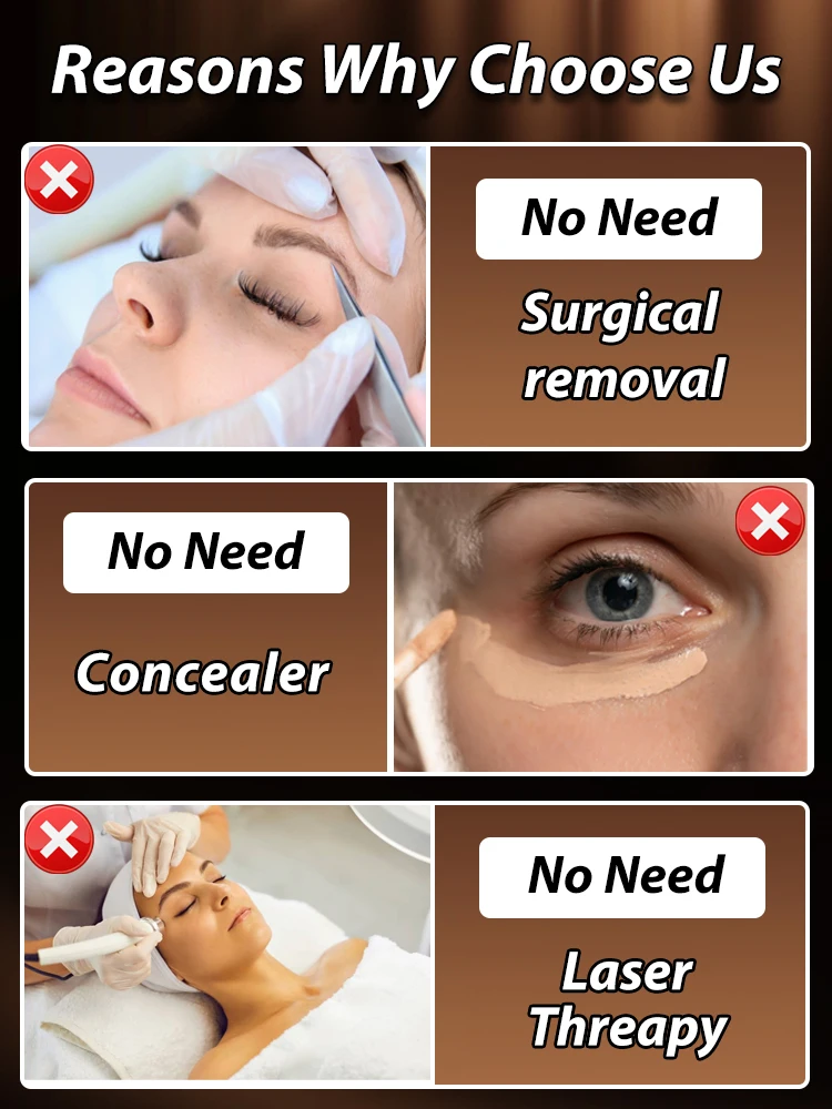 Eye Cream Eye Bags Disappear Care
