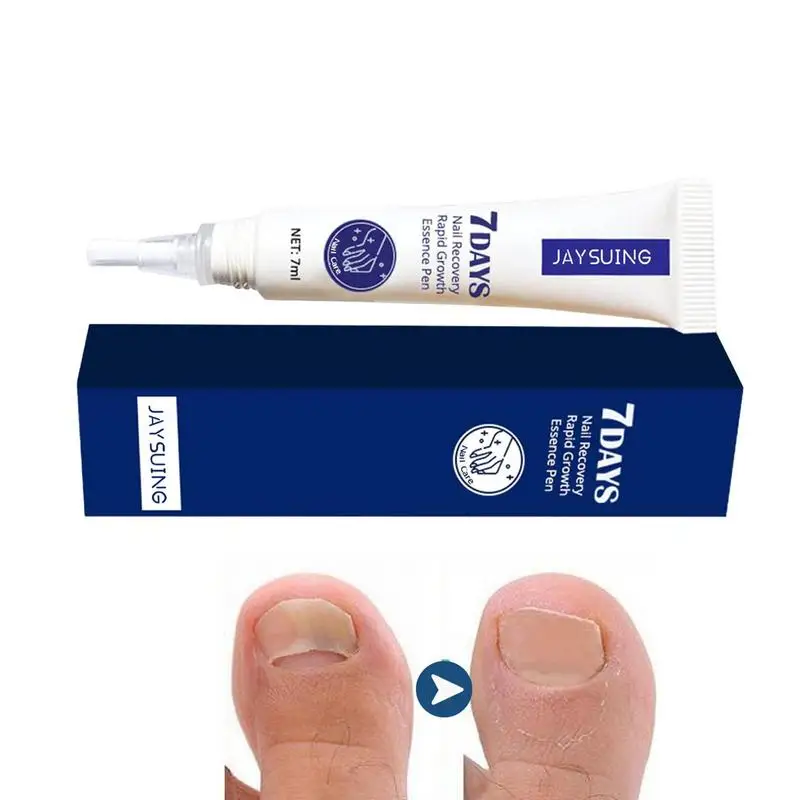 

Feet Nails Repair 7 Day Nail Recovery Rapid Growth Pen 7ml Repair Infected Nail Serums Stopping Discolored Nails