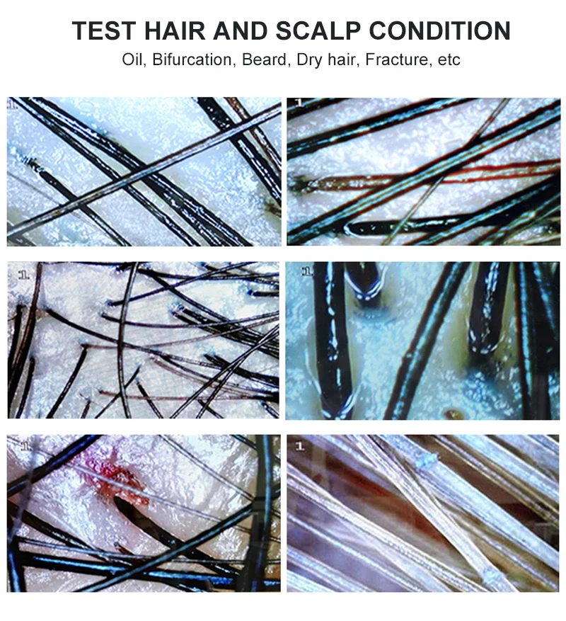 Skin Tester Scalp Detector 7 inch Skin Analyzer Machine Scalp Detector Hair Follicles Oil Moisture Tester Facial Skin Hair Analyser Machine Rechargeable
