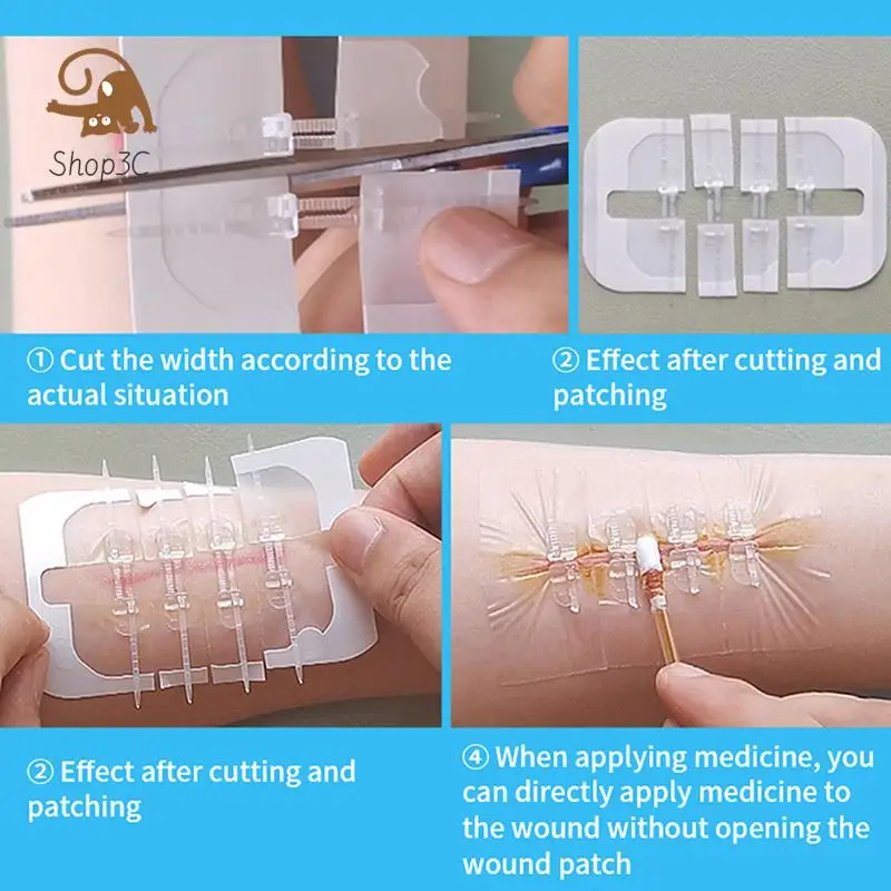 2pcsZipperTieWoundClosurePatchHemostaticPatchWoundFastSuture