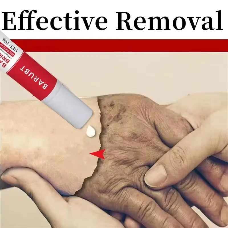 Facial Cream Whitening Freckles Removal Melasma Dark Spots Corrector Lighten Melanin Pigmentation Brighten Anti-Aging