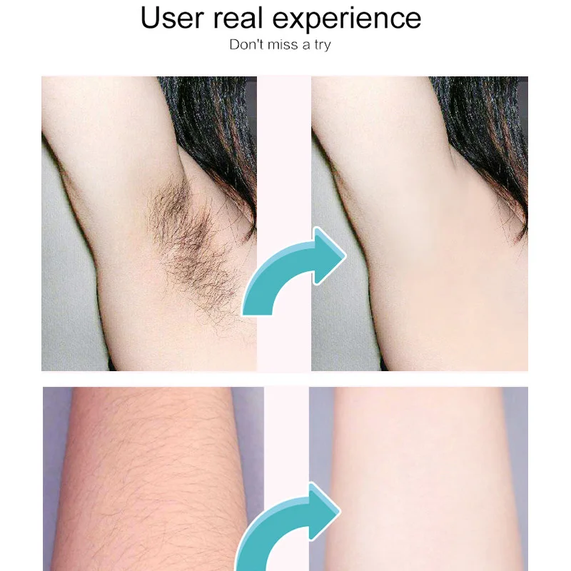 20pcs 18x9cm Depilatory Wax Strips For Hair Removal Epilator Waxing Strip Cold Wax Paper For Face Neck Arm Leg Body Skin Care hair removal wax hair removal tool