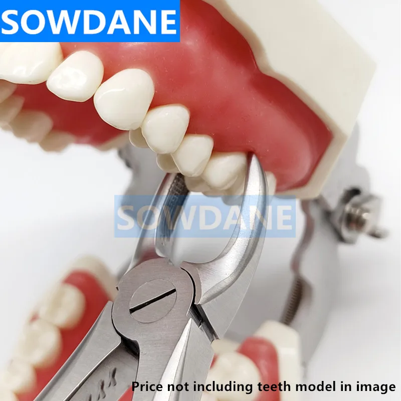 Tooth Extraction Price 100 Authentic randa.tn
