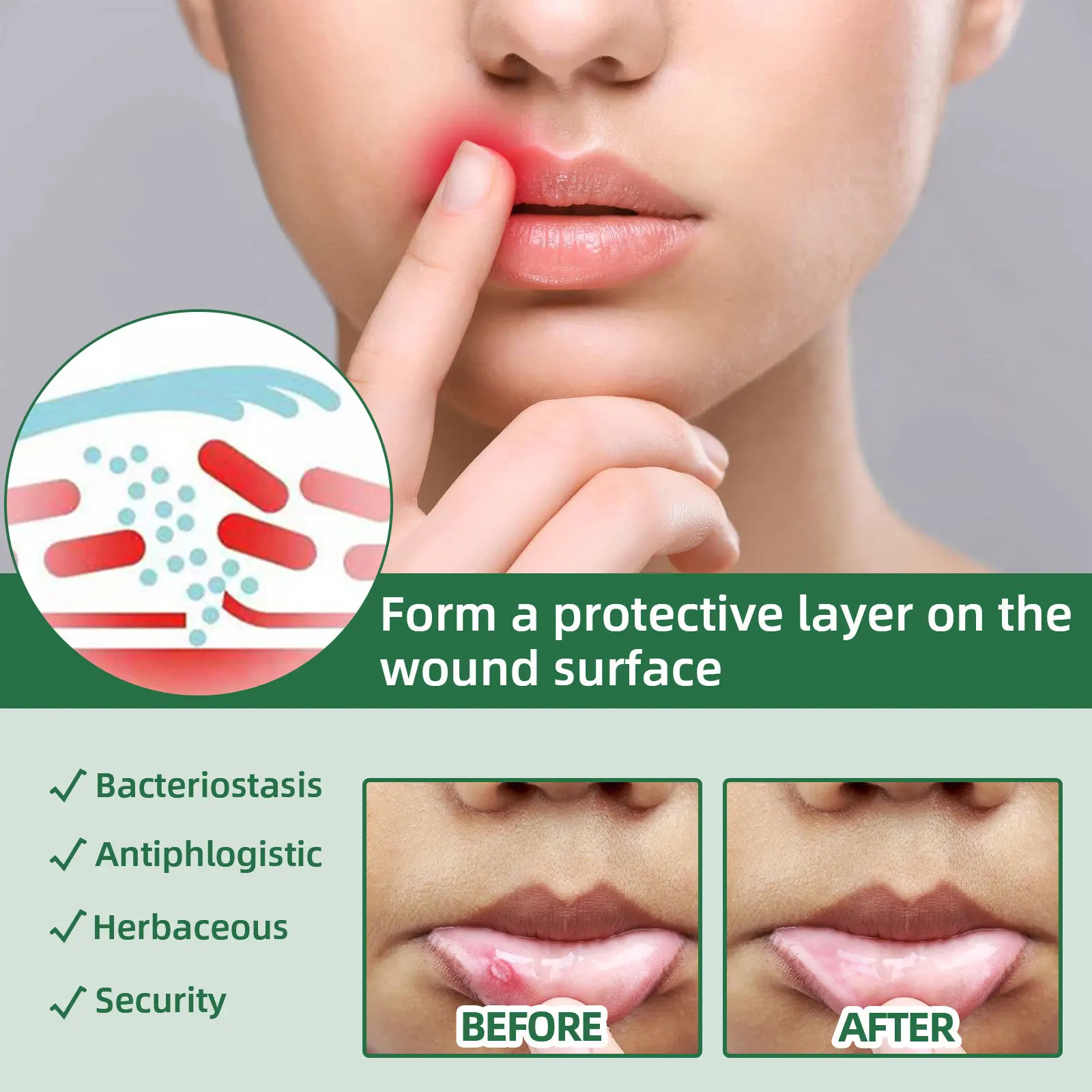 Oral Ulcer Spray 20ml herbal oral spray Canker Sores Swelling in The Gum Fresh Breath and Mouth Ulcer Care Spray Belleza Y Salud Oral Care