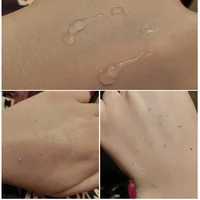 Moisturizing Gel for Full Lips Moisturizing Gel for Full Lips