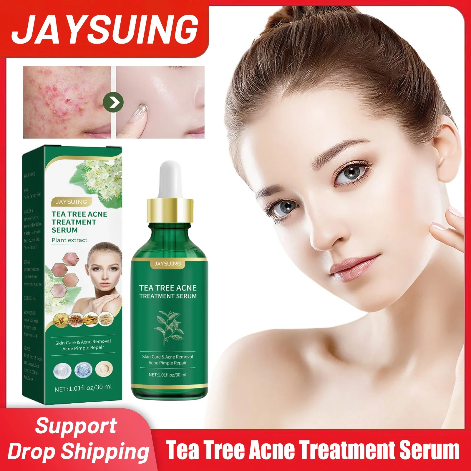 

Tea Tree Acne Treatment Serum Acne Marks Removal Oil Control Shrinking Pores Moisturizing Anti Inflammation Face Essence 30ml