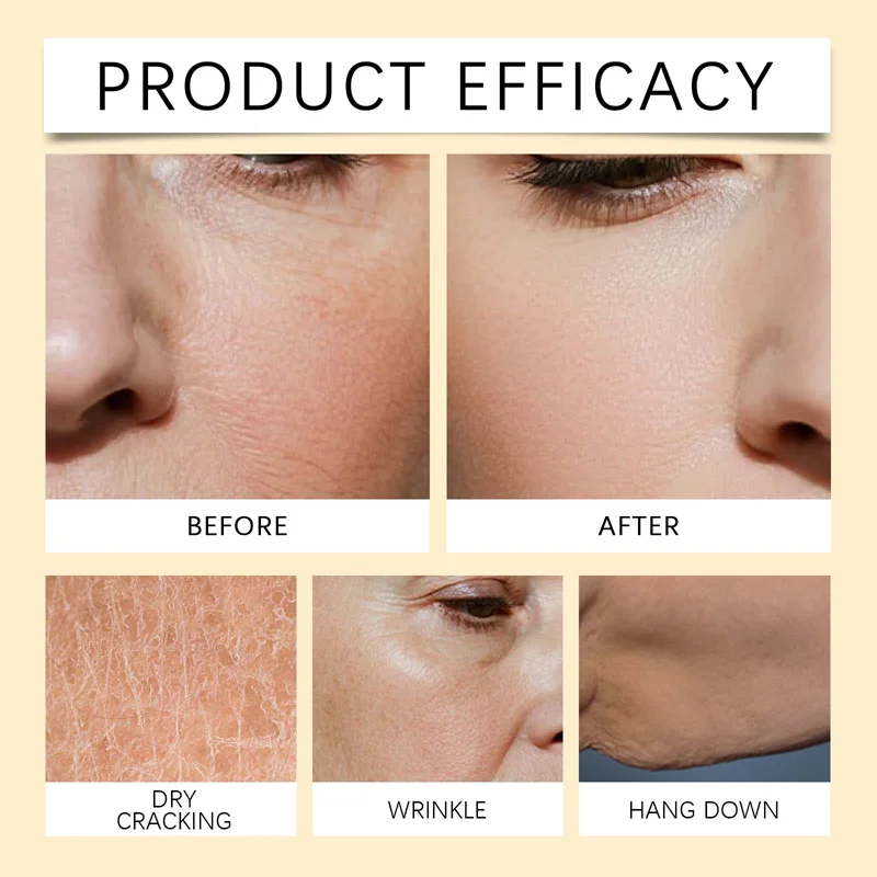 YUITIKU Bee Venom Body Cream firms the face, lifts the body, enhances chest contours, and softens the skin.