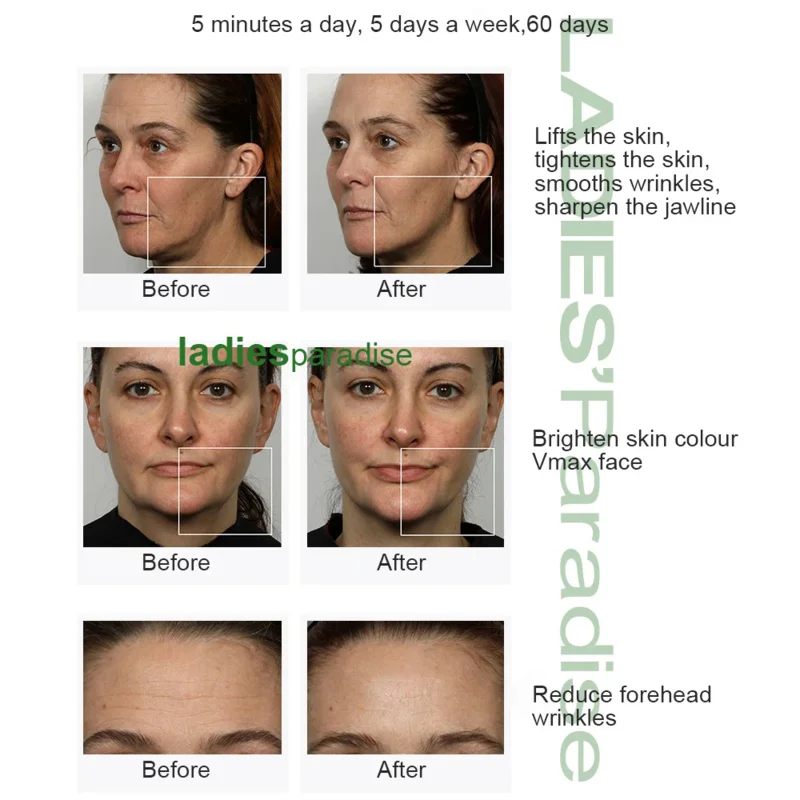 Galvanic Therapy Facial Electroporation Face Lifting Tighten Wrinkle Removal Skin Care Body Massager Beauty Salon Home Machine