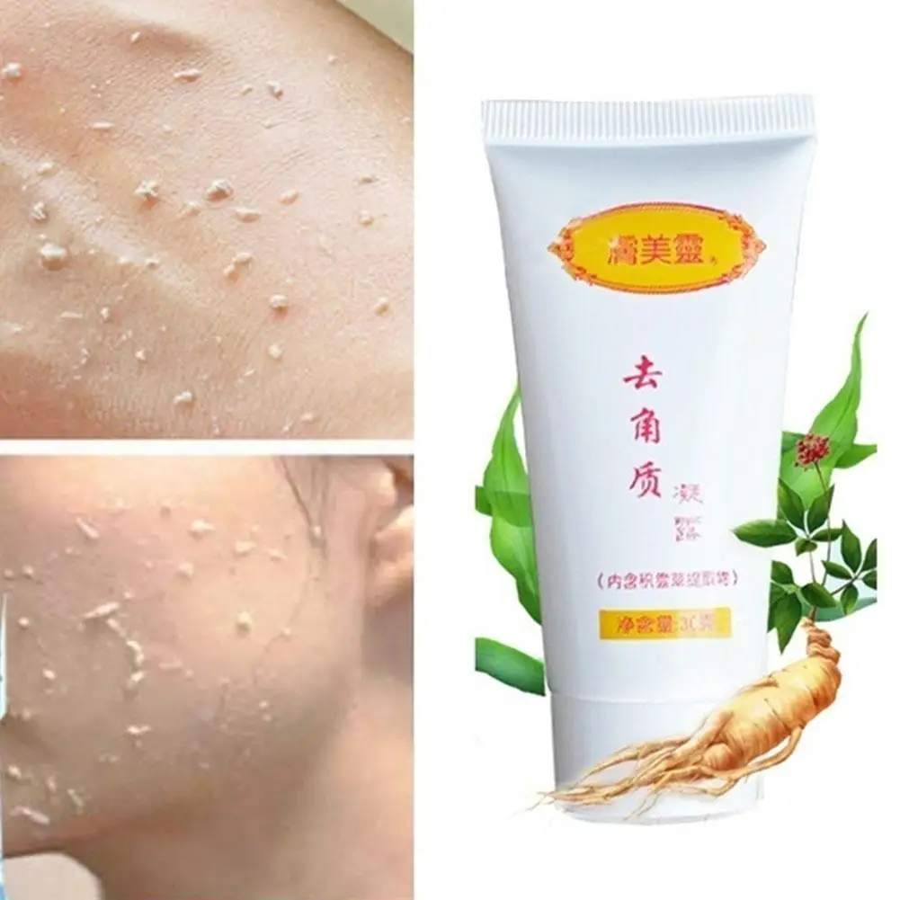 Facial Exfoliant 30g Facial Cleanser Exfoliating Gel Natural Facial Exfoliator Whitening Brightening Peeling Cream Gel Face Scrub Removal