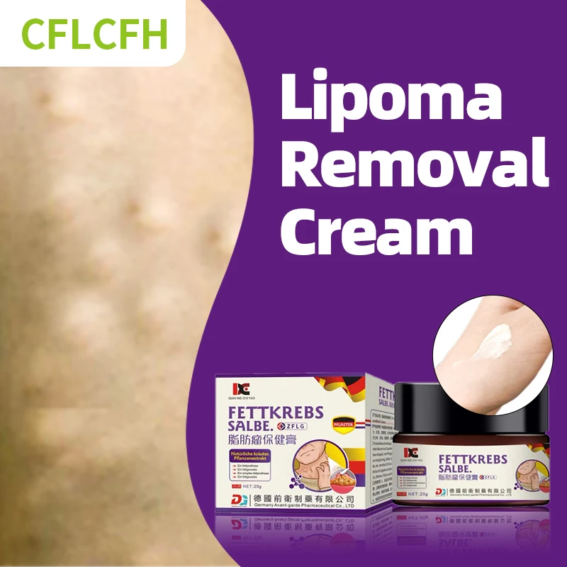 

Lipoma Removal Medicine Cream For Lipomas Cyst Fat Lump Cellulite Fibroma Treatment Patch Fat Mass Remover German Secret Recipe