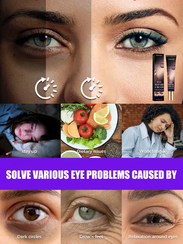 The most effective eye cream eliminates wrinkles eye bags dark circles tightens skin brightens skin in 7 days beauty enhancement product