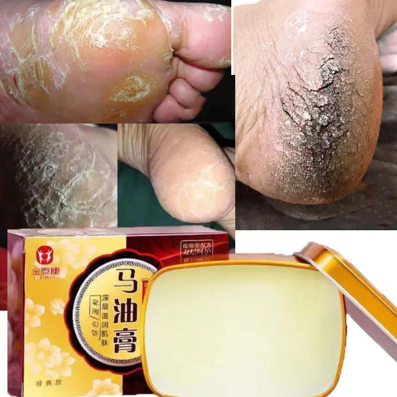 

80g Horse Oil Anti-dry and Cracked Foot Cream Heel Crack Repair Cream To Remove Dead Skin Foot Care Home Winter Skin Care