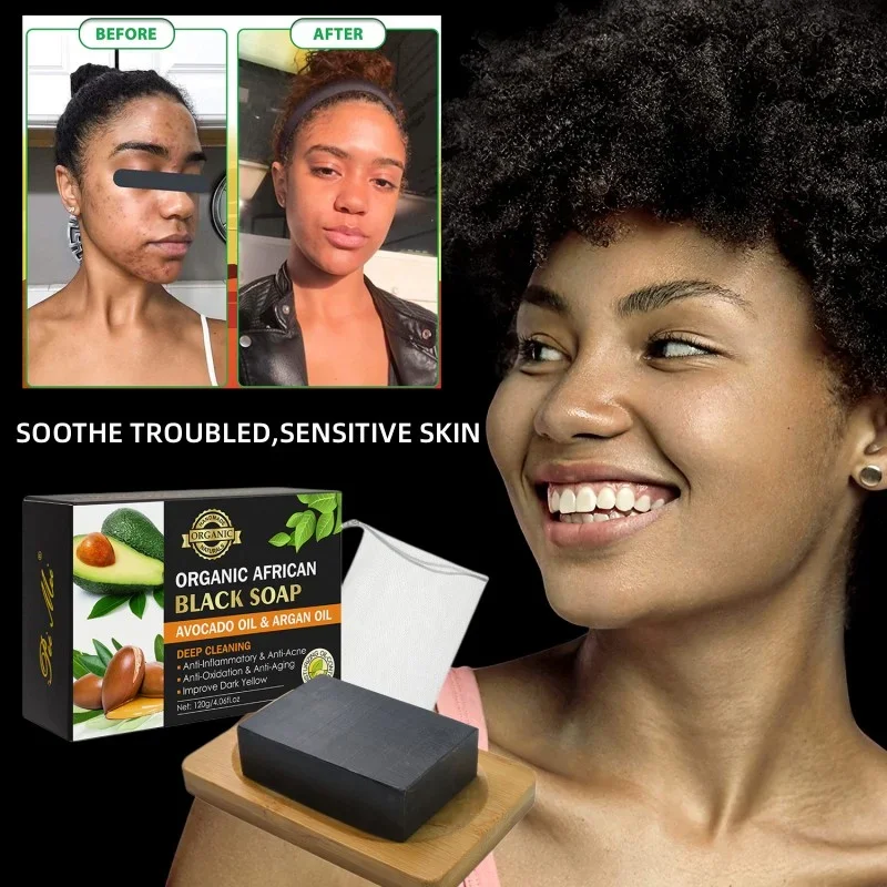 

Shea Butter Argan Oil African Black Soap Moisturizing Acne Cleanser for Clear Skin Care Handmade Soap Bar for Face Body