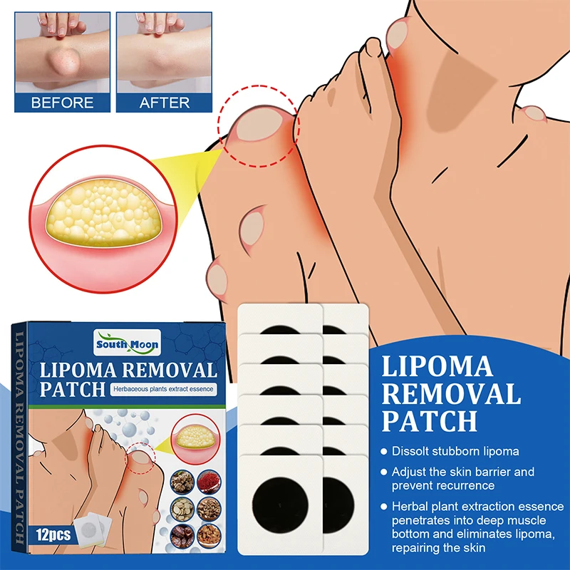 Lipoma Removal Cream 12pcs/20g Antitumor Remove Fat Lump Ointment Nodular Discomfort Skin Cyst Swelling Pain Relief Plaster