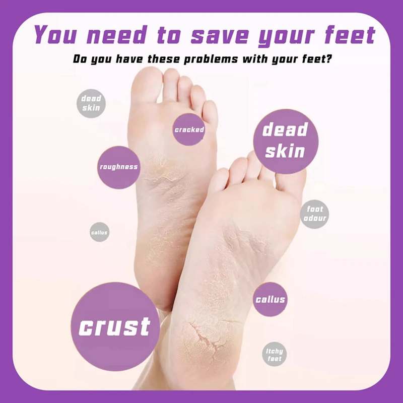 Electric Foot Callus Remover Rechargeable Foot File Pedicure Tools For Feet Foot Sander Nail Grinder Tool For Men Women 4