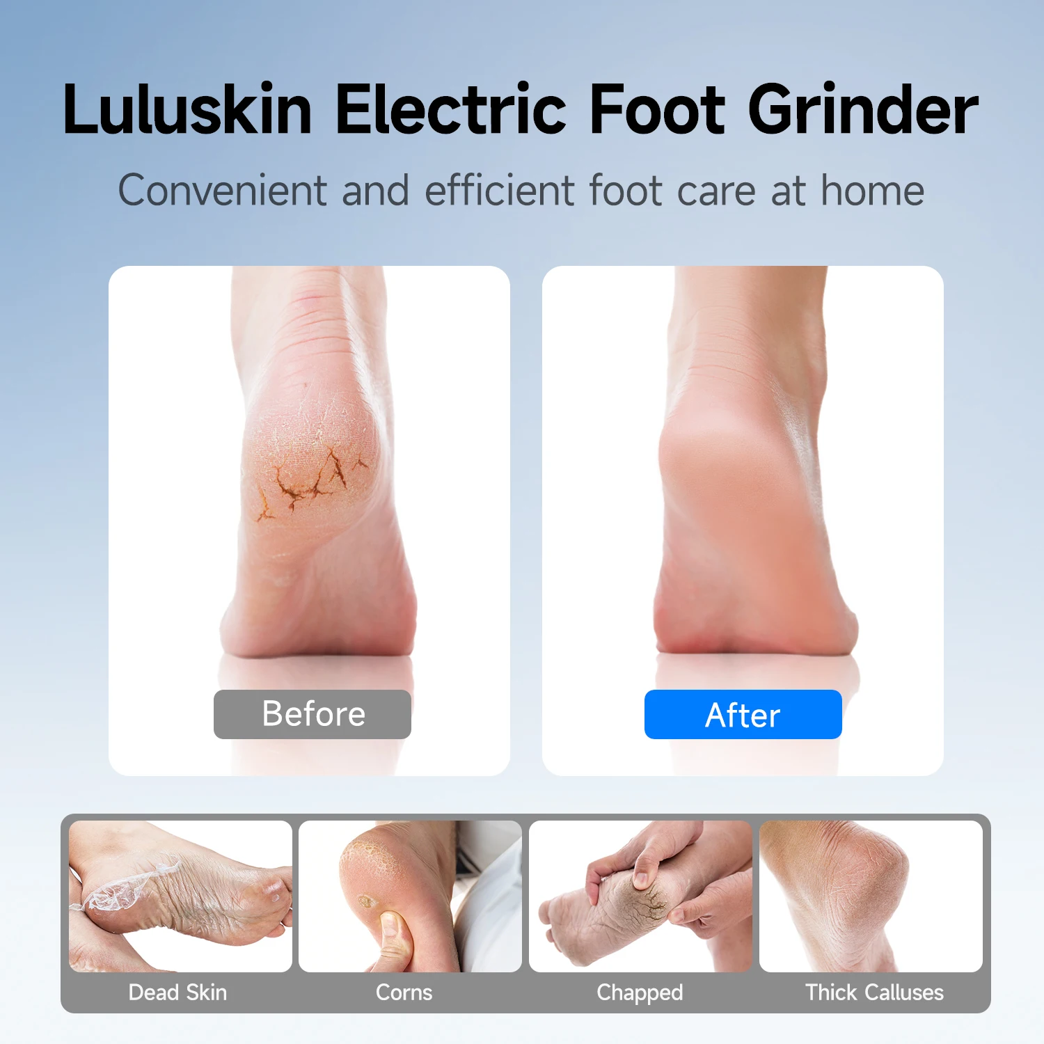luluskin A1 Broyeur exfoliant pour peaux mortes et callosités - Outil de soin des pieds à usage personnel et domestique_voghion.com
