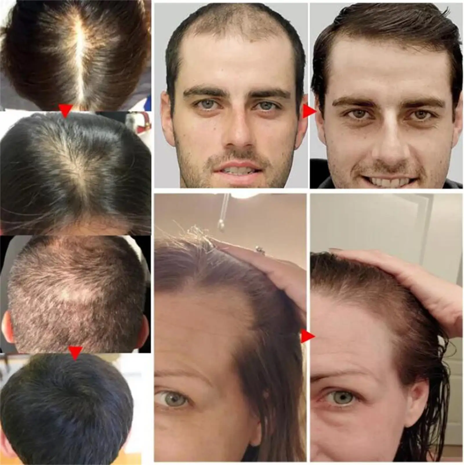 Description Picture 4 of itemPowerful Hair Growth Serum Spray Natural Anti Hair Loss Products Repair Nourish Hair Roots Fast Regrowth Hair Care Men Women