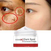 

VOVA Dark Spot Corrector Cream Remove Melasma Acne Spot Pigment Melanin Dark Spots Pigmentation Freckle Removal Whitening Cream