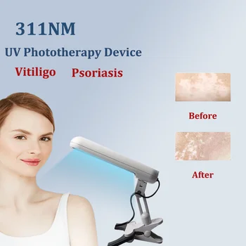 311nm UVB Phototherapy Lamp 1