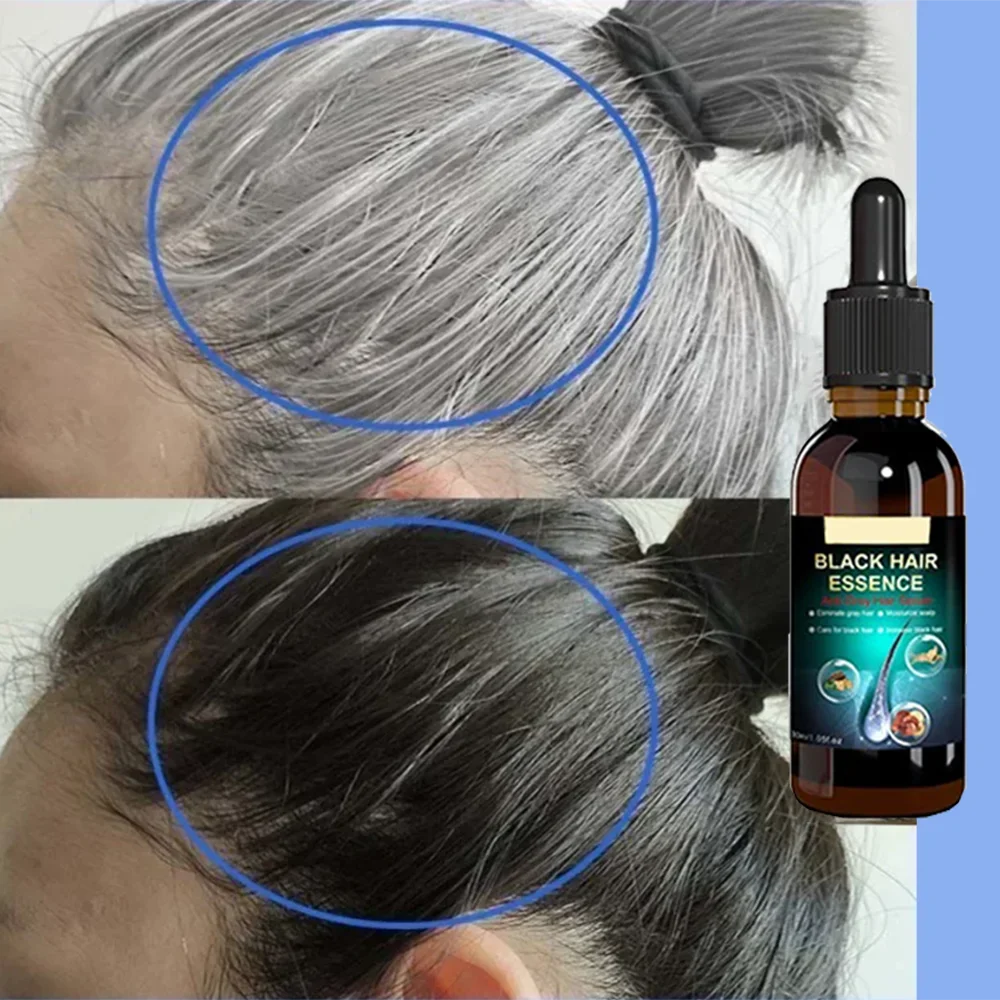 Anti-grey hair essence Serum treatment restore natural hair color and restore healthy White To Black hair treatment