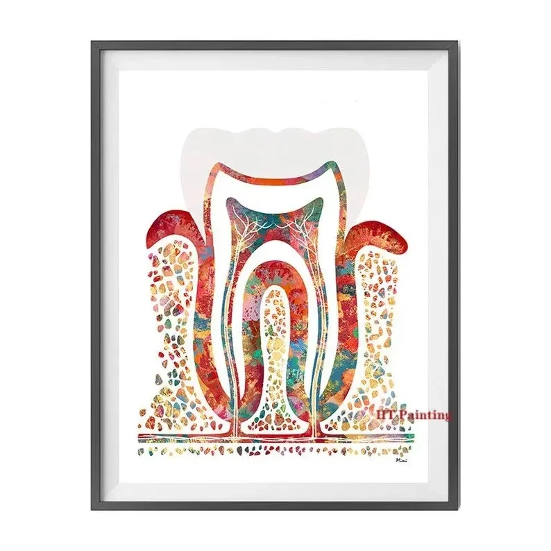Modern Dental Art - Tooth Implant Anatomy Canvas Poster